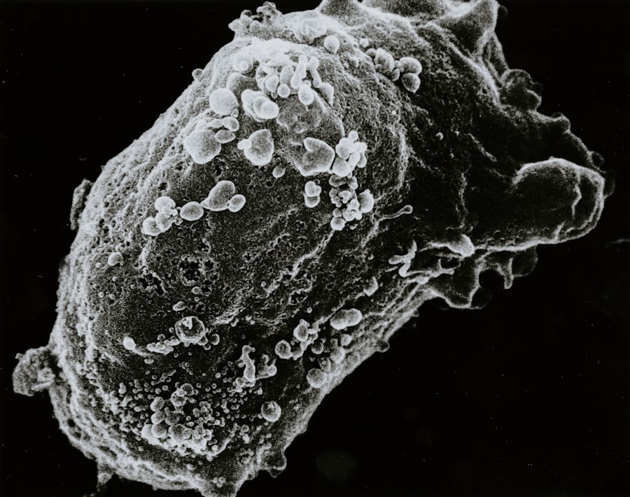 stem cell banking cost